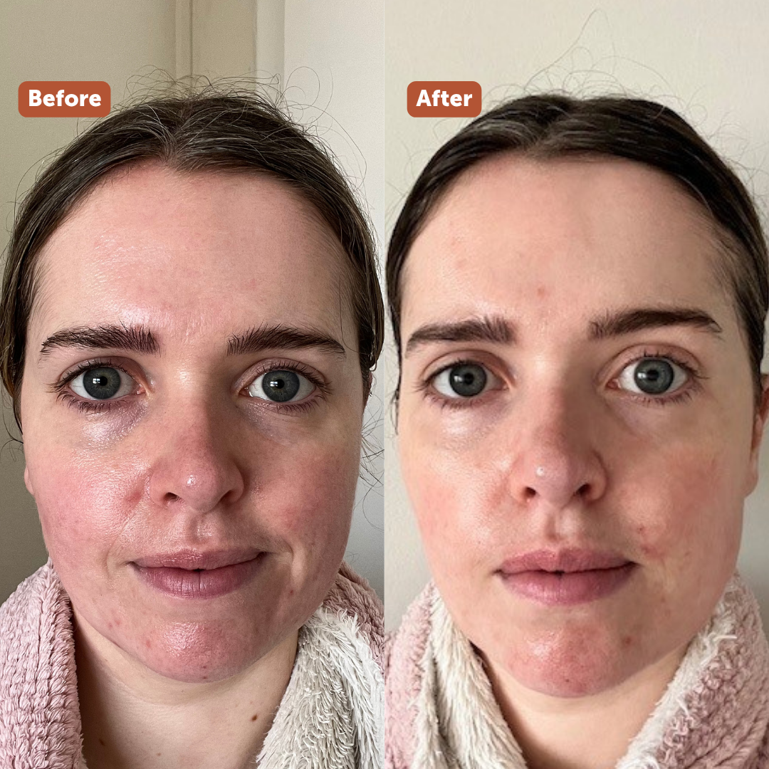 BRIGHTENING FACIAL CREAM