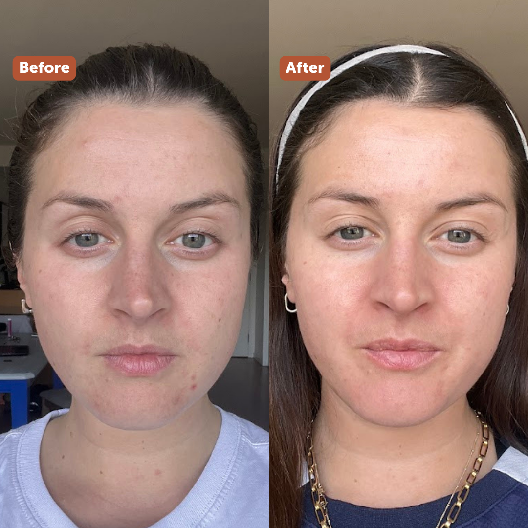 BRIGHTENING MASK