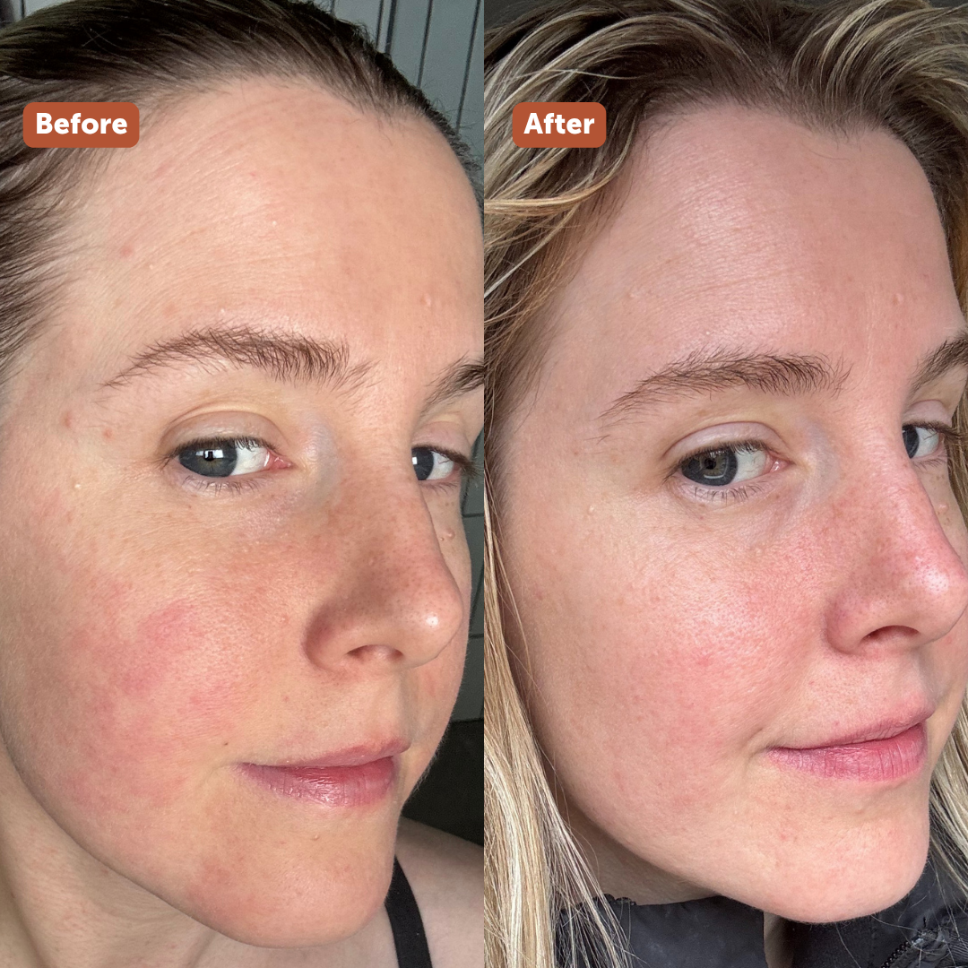 BRIGHTENING SERUM